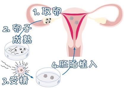 冷冻储存